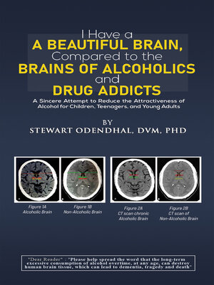 cover image of I Have a Beautiful Brain, Compared to the Brains of Alcoholics and Drug Addicts